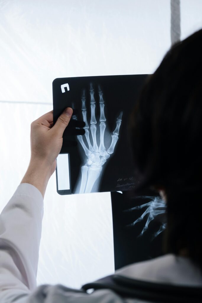 Doctor analyzing hand X-ray for signs of injury or bone health evaluation.
